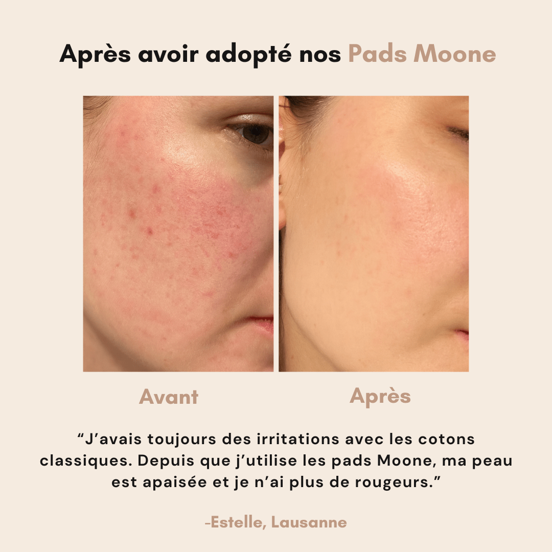 Pads démaquillants réutilisables